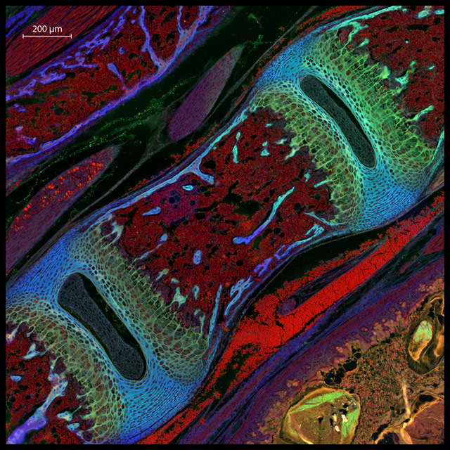 Mouse vertebrae section by Michael Nelson et al, Alabama, US