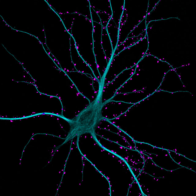 Hippocampal neuron receiving excitatory contacts, by Dr. Kirian Boyle, glascow