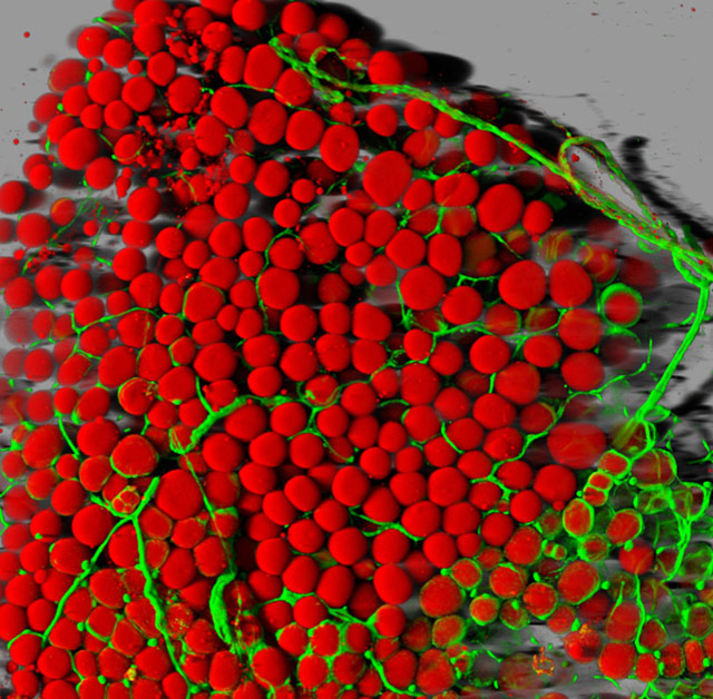 mouse fat tissue, National Heart, Lung and Blood Institute, Light Microscopy Core Facility, Dr. Daniela Malide